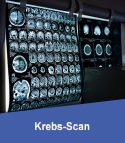 Krebs-Scan